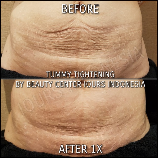 Beauty Treatment